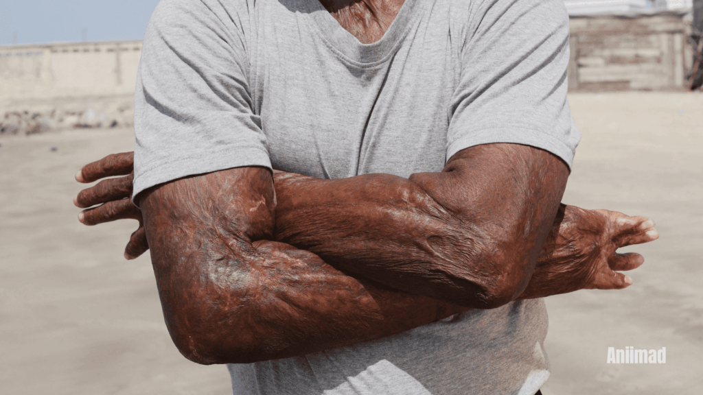 Spiritual Meaning of Scars