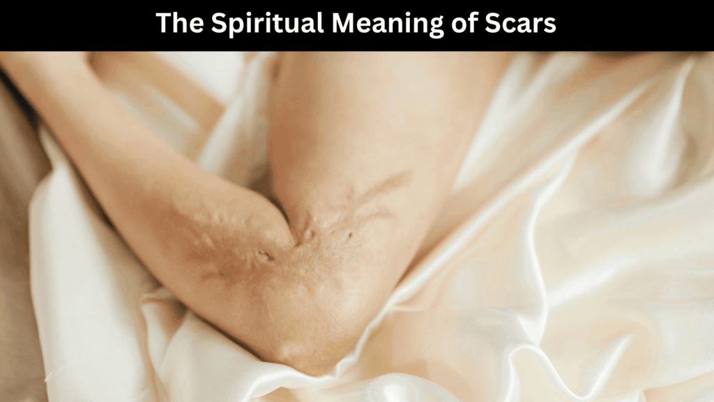 Spiritual Meaning of Scars